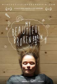 My Beautiful Broken Brain (2014) M4ufree
