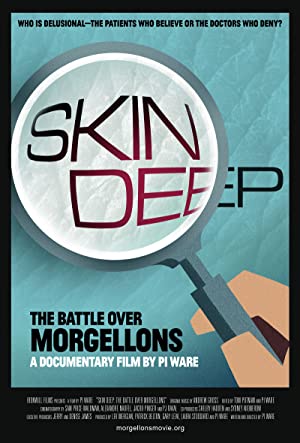 Skin Deep: The Battle Over Morgellons (2019) M4ufree