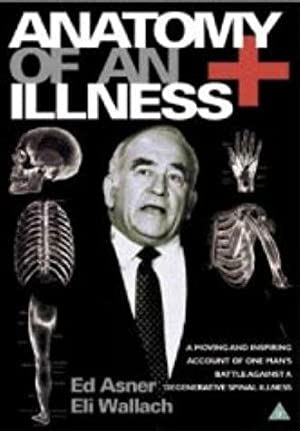 Anatomy of an Illness (1984) M4ufree