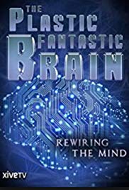 The Plastic Fantastic Brain (2009) M4ufree